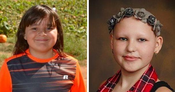 Un băiat de 10 ani și-a crescut părul timp de 2 ani pentru peruca prietenei care suferă de alopecie