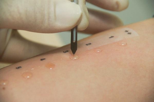 Лабораторная диагностика на аллергены. Обзор лабораторий, где можно сделать аллергопробы в Кишиневе