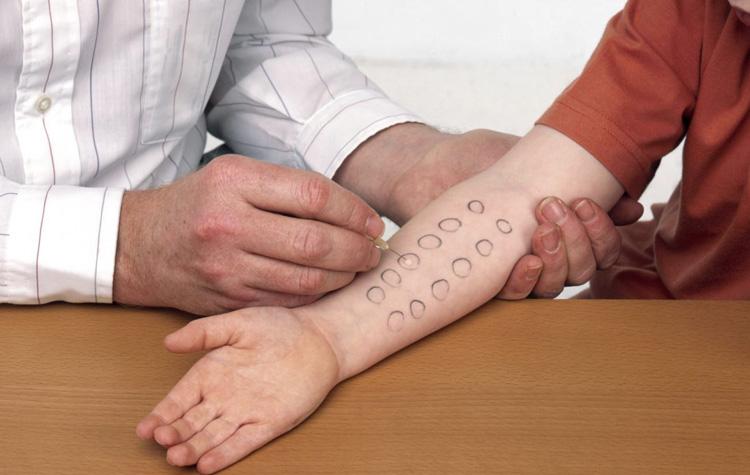 Лабораторная диагностика на аллергены. Обзор лабораторий, где можно сделать аллергопробы в Кишиневе