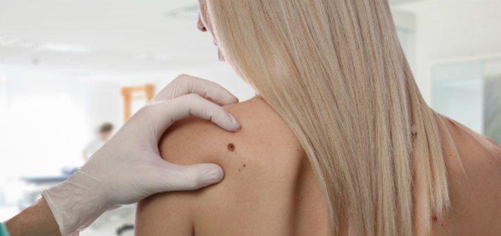 Pericolele verii: bronzul şi melanomul