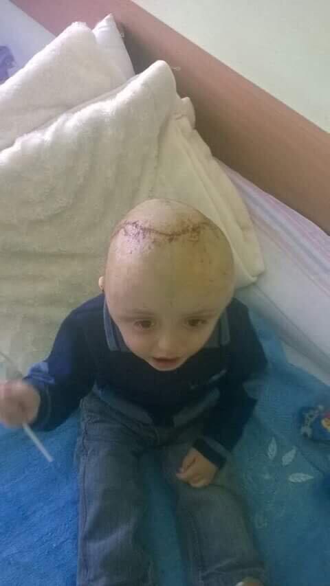 Un băiețel de doar trei ani, diagnosticat cu o afețiune gravă a craniului, are nevoie de ajutor