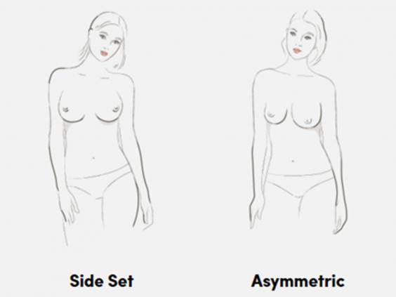 Существует 9 типов женской груди. Как их различить!