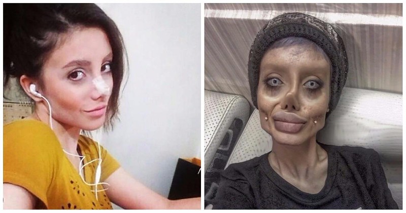 Иранка сделала 50 пластических операций, чтобы выглядеть, как Анджелина Джоли (фото)