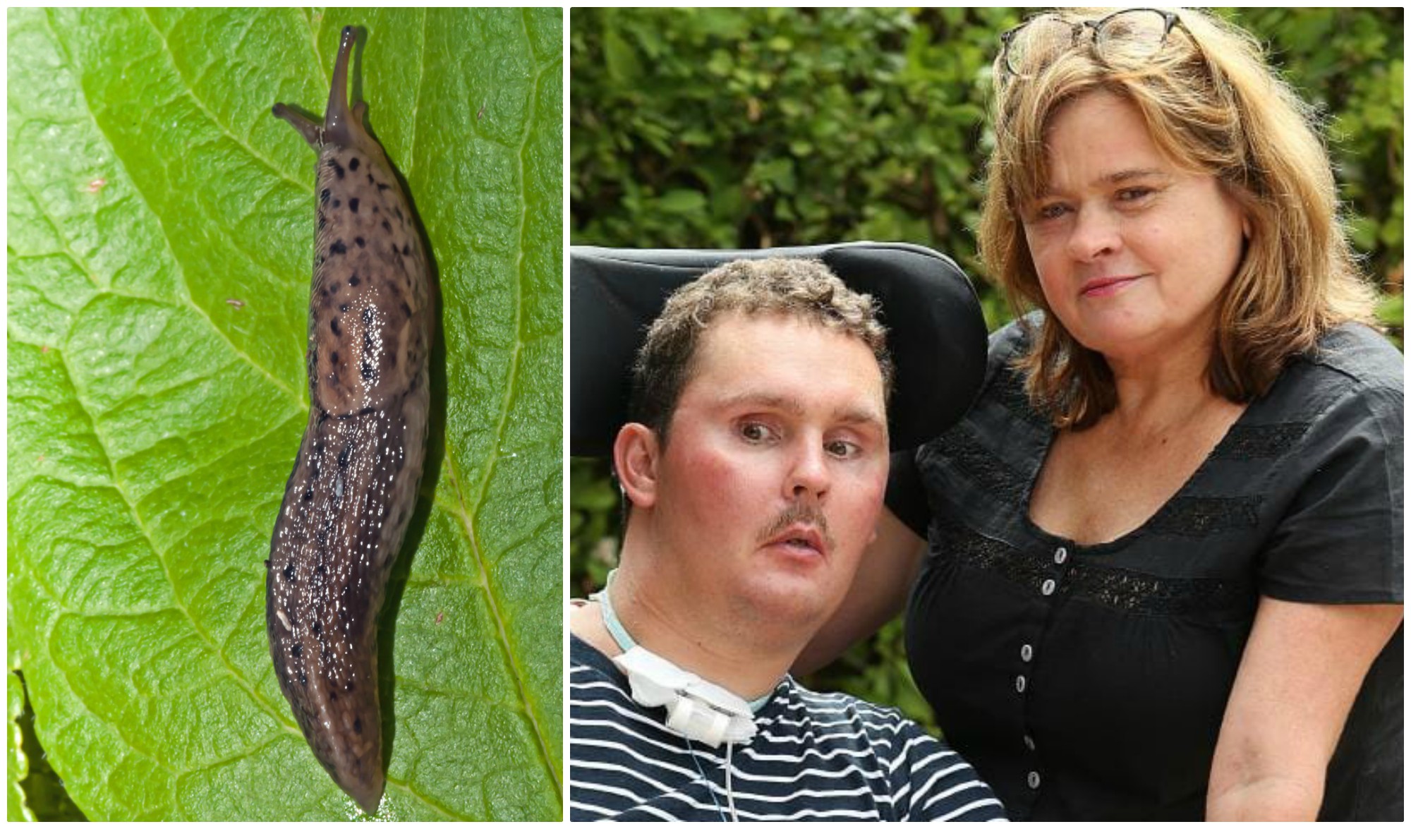 Un adolescent a mâncat o moluscă și a rămas invalid