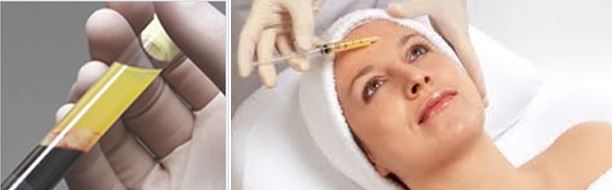 Tehnica inovatoare pentru întinerirea și ridicarea pielii feței