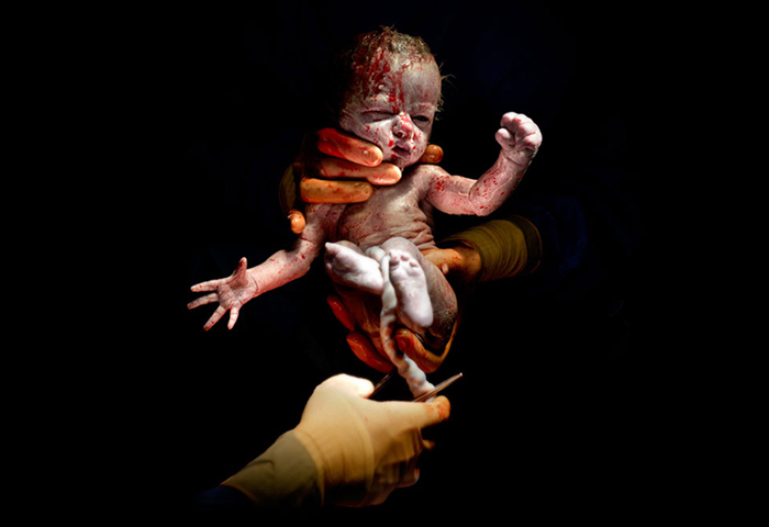 Первые секунды жизни: фотографии младенцев сразу после рождения