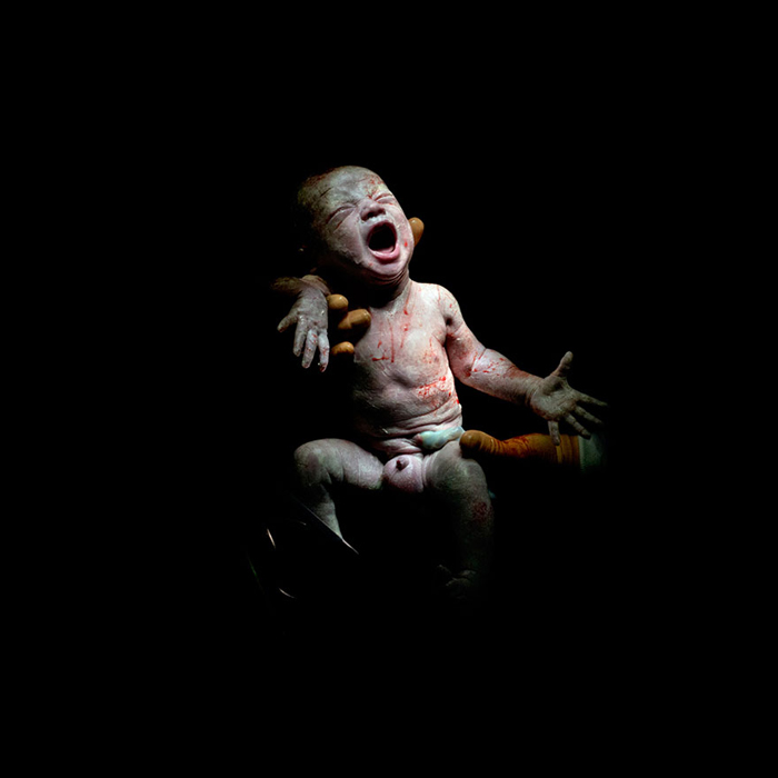 Primele secunde de viață: fotografiile bebelușilor imediat după naștere