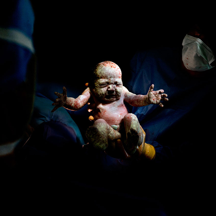 Primele secunde de viață: fotografiile bebelușilor imediat după naștere