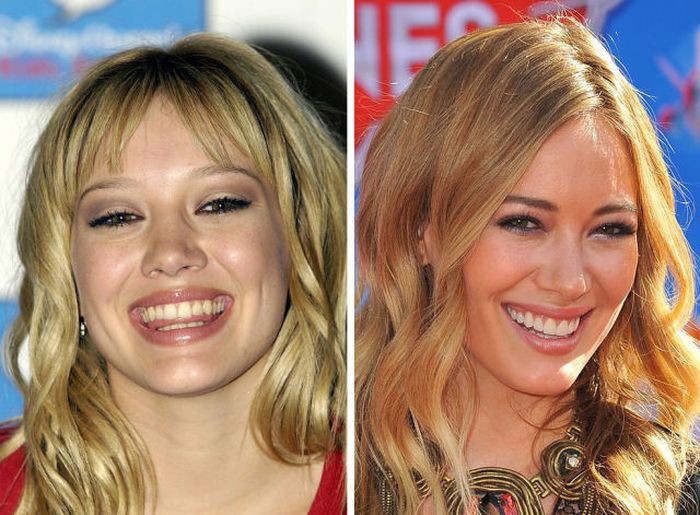 Улыбка на миллион: 20 примеров того, как зубы поменяли внешность знаменитых людей