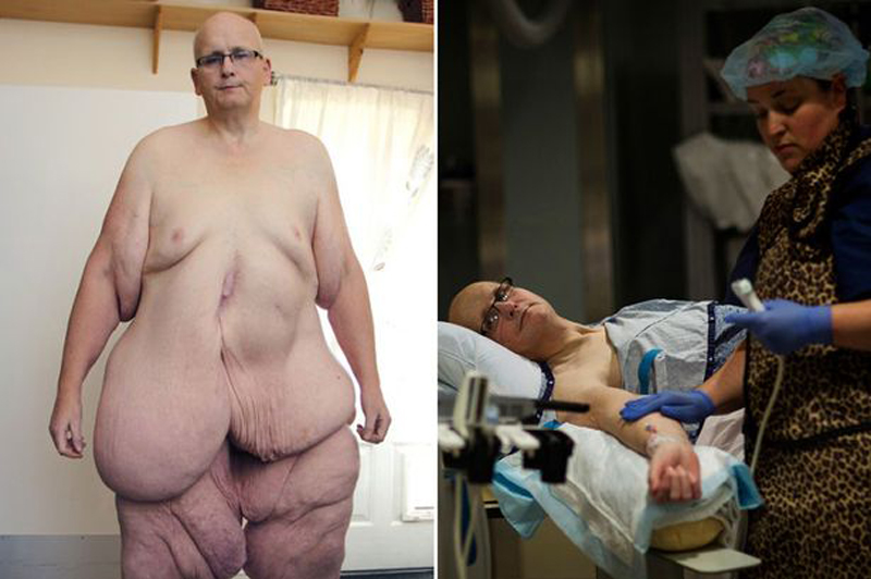 Этот мужчина похудел на 300 кг ради своей любимой... История, поражающая воображение