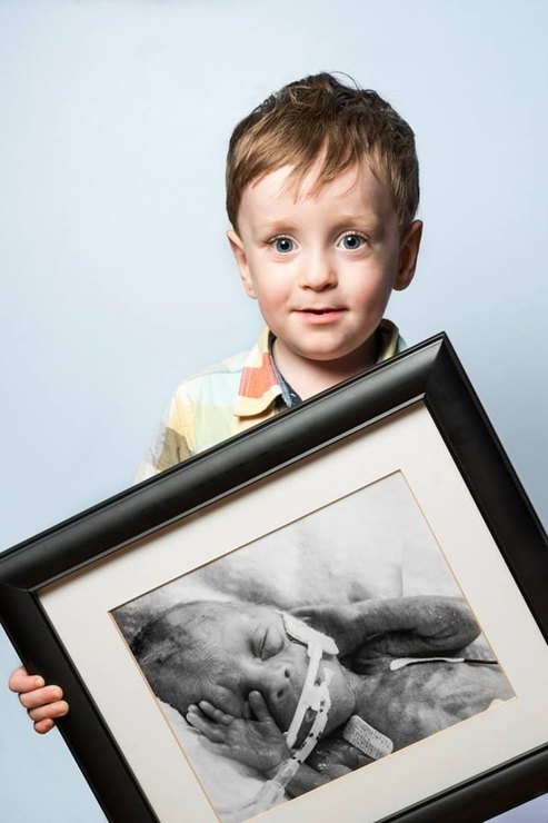 Выросшие дети, которые родились раньше срока, показали свои первые фото