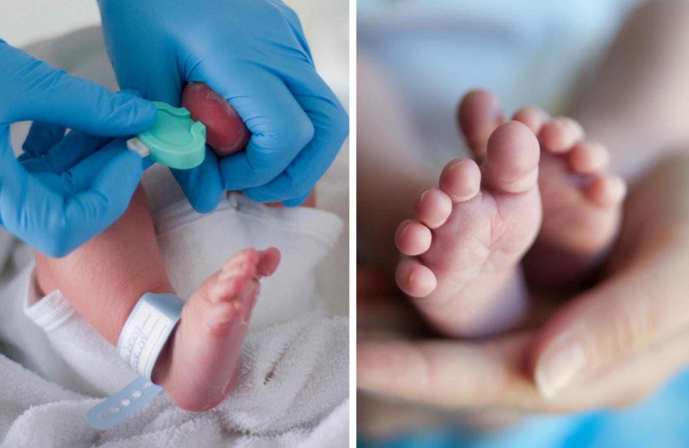 Analiza de sânge din călcâiul nou-născutului: două picături de sânge care pot schimba întreaga viață