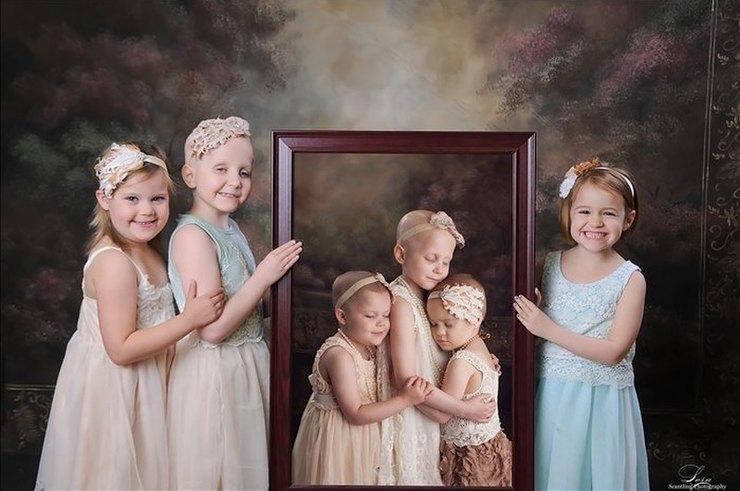 Три малышки, победившие рак, стали героинями трогательного фотопроекта