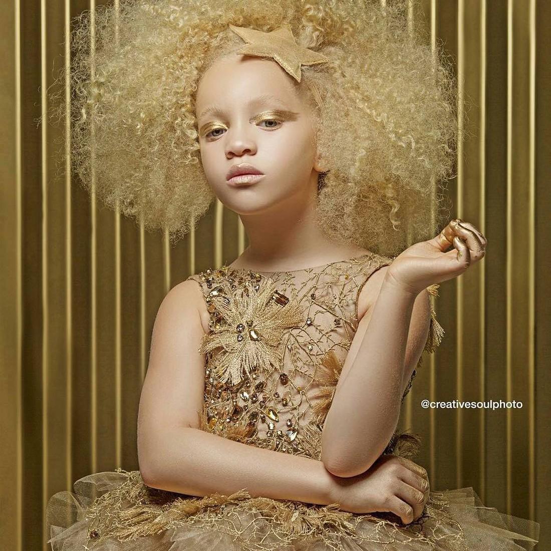 Афроамериканка-альбинос штурмует fashion-индустрию и покоряет интернет