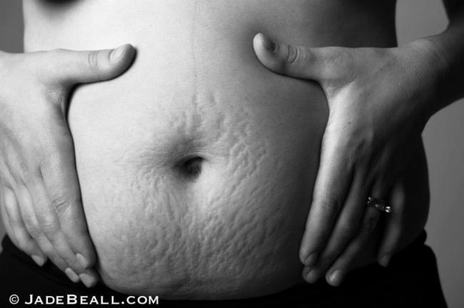 Фотопроект «Тела матерей».Что беременность делает с женским телом