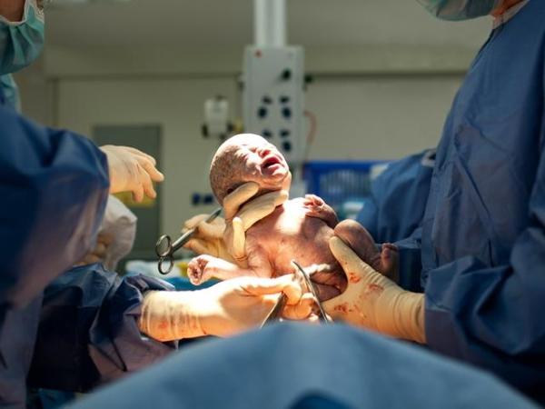 Nașterea prin cezariană. Interviu cu specialistul Rodica Catrinici