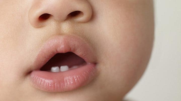 Apar dinții bebelușului? Cele 10 semne ca să îți dai seama
