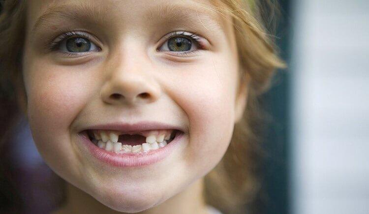Смена молочных зубов коренными. Задаем вопросы стоматологу