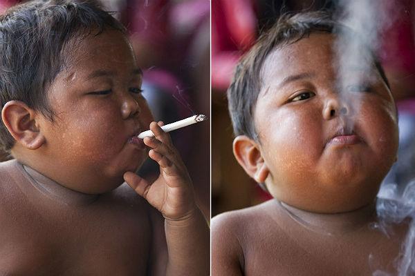 Ему 2 года, но он ежедневно выкуривает 40 сигарет!  Это одна из самых ужасных историй...