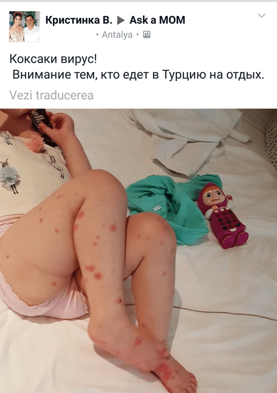 Atenție, părinți! Pericol de infecție cu virusul Coxsackie pe litoralul turcesc