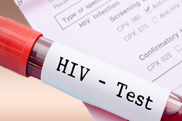 Pe 1 decembrie, doritorii pot face gratuit testul rapid la HIV pe salivă